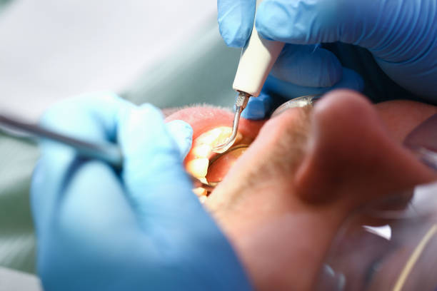 Best Emergency Treatment for Dental Infections or Abscesses in Hubbard, TX
