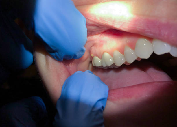 Best Emergency TMJ Treatment in Hubbard, TX