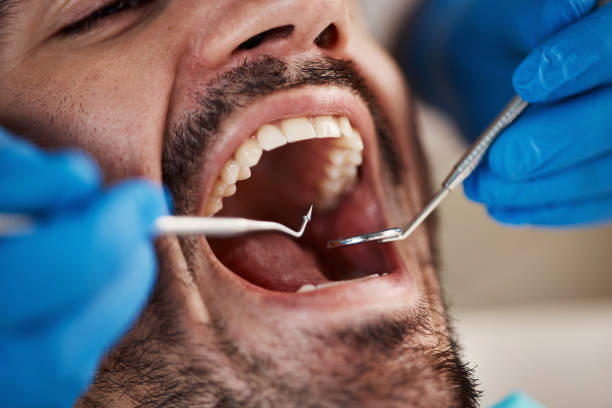 Best Urgent Care for Lost Fillings or Crowns in Hubbard, TX